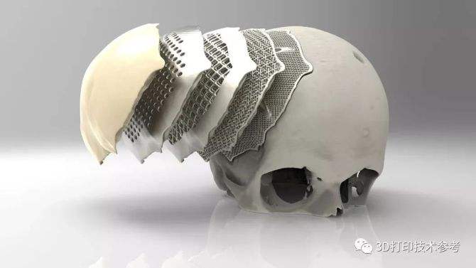鈦合金3D打印技術(shù)